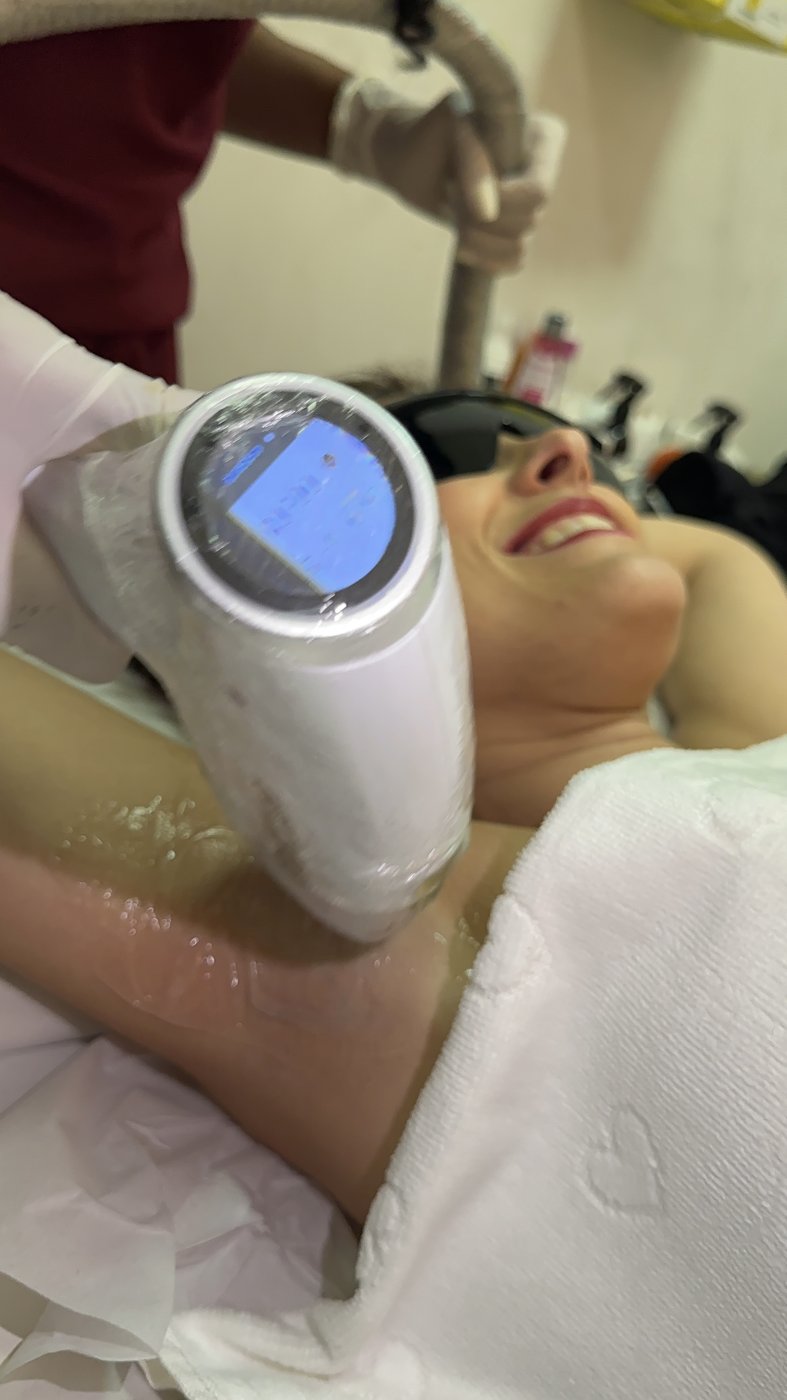 Cliente sorrindo durante a depilação a laser